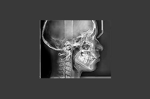 Radiología Yangüela rayos x