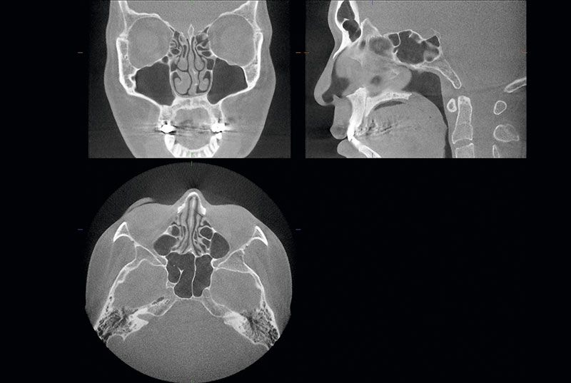 Radiología Yangüela TAC dental morita