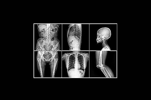 Radiología Yangüela radiografía
