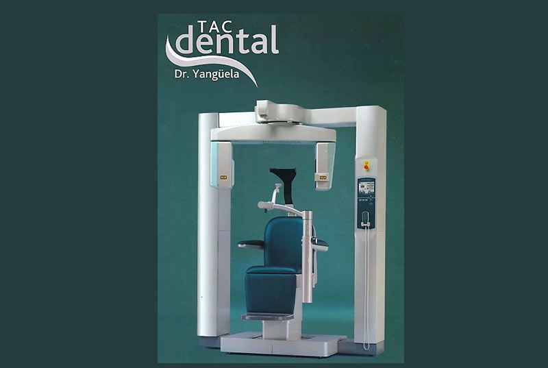 Radiología Yangüela equipo de TAC dental 